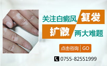 深圳市白癫疯医院讲解哪些白癜风的症状告诫您疾病的来袭