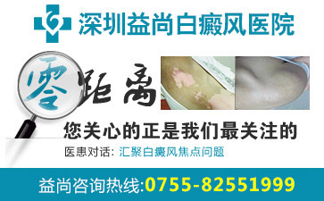 深圳市白殿风医院讲解要怎样做才能预防白癜风的出现呢