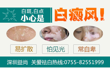 深圳宝安区哪家医院治白斑病解答白癜风病人的常见检查方法